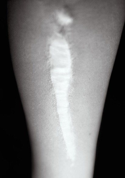 Elena Ciobanu - Scars