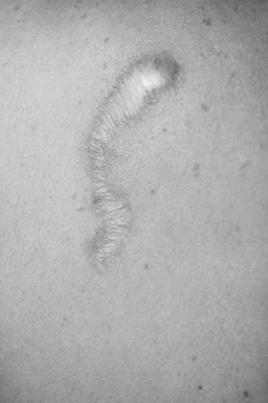 Elena Ciobanu - Scars