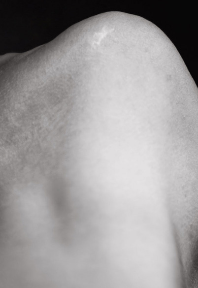 Elena Ciobanu - Scars