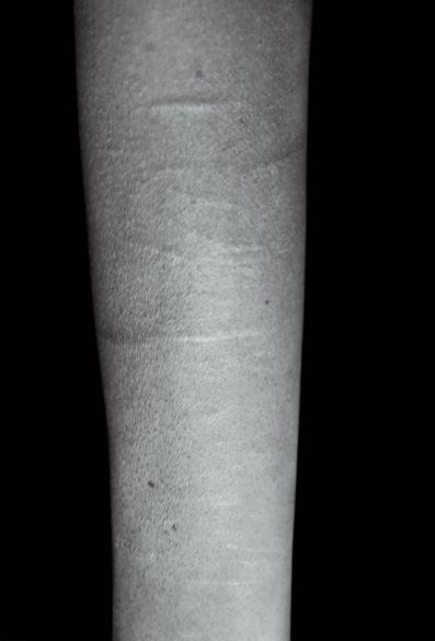 Elena Ciobanu - Scars