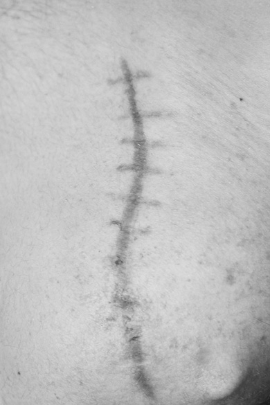 Elena Ciobanu - Scars