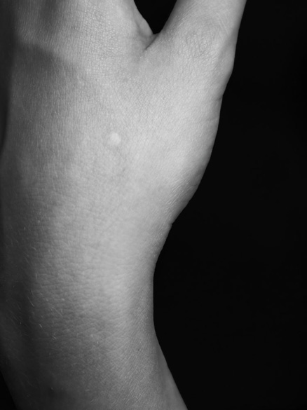 Elena Ciobanu - Scars