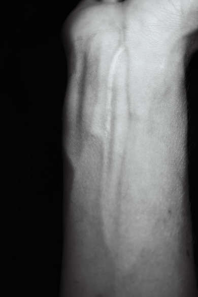 Elena Ciobanu - Scars