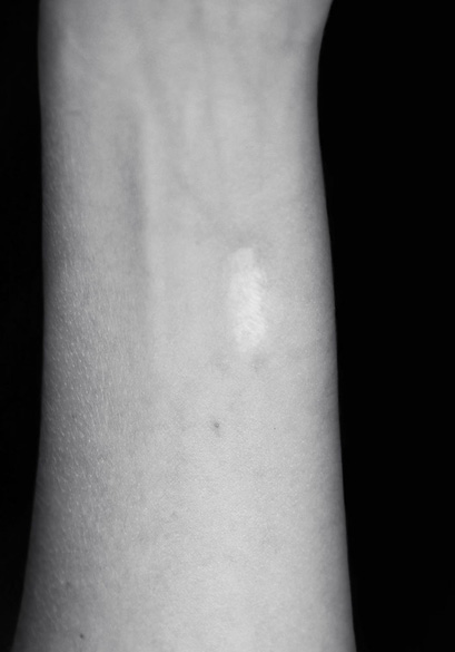 Elena Ciobanu - Scars